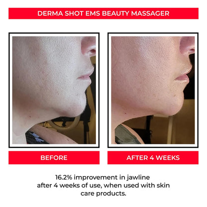 EMS Face Lifting Machine Facial Massager Microcurrent Roller Skin Tightening Rejuvenation Double Chin Removal Beauty Device