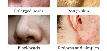 Remove Large Pores Serum Lactic Acid Facial Pore Shrinking Repairing Products Pore Minimizing Firming Smooth Korean Skin Care