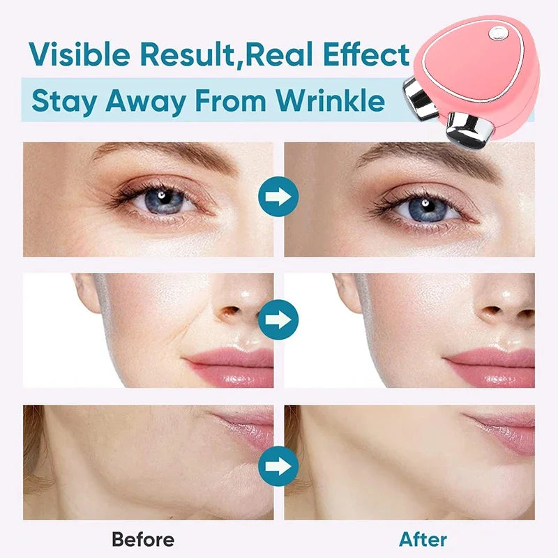 EMS Face Lifting Device Facial Microcurrent Roller Massage Sonic Vibration Skin Tightening Rejuvenation Anti Wrinkle Beauty Care
