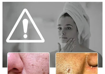 Remove Large Pores Serum Lactic Acid Facial Pore Shrinking Repairing Products Pore Minimizing Firming Smooth Korean Skin Care