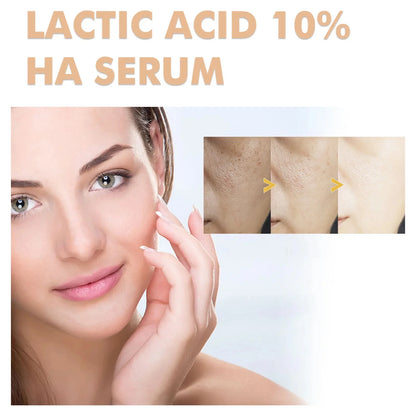Remove Large Pores Serum Lactic Acid Facial Pore Shrinking Repairing Products Pore Minimizing Firming Smooth Korean Skin Care