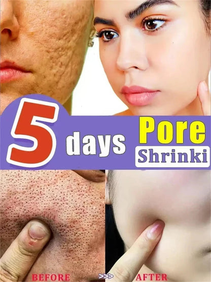 Remove Large Pores Serum Lactic Acid Facial Pore Shrinking Repairing Products Pore Minimizing Firming Smooth Korean Skin Care