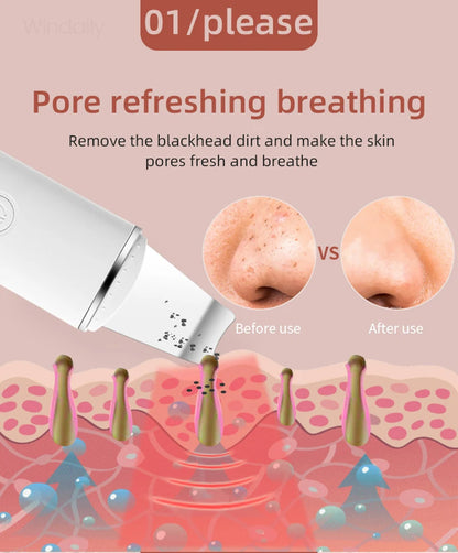 Ultrasonic Skin Scrubber | Blackhead Remover & Face Lifter