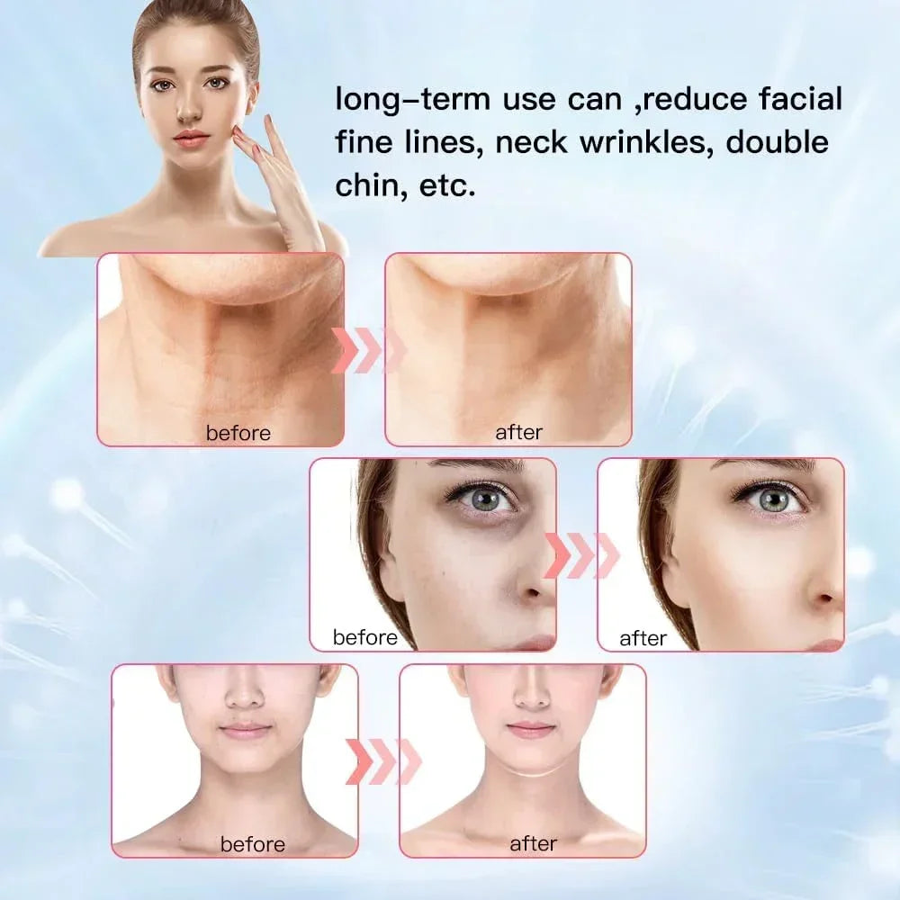 EMS Neck Face Beauty Device Facial Lifting Machine Skin Tighten Reduce Double Chin Anti Wrinkle Remove Lifting SkinCare Massager